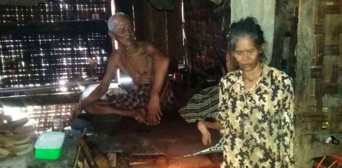 Sungguh Malang Nasib Warga Lebak Banten, Tinggal Di Gubuk Reyot Dengan Penyakit Menahunnya